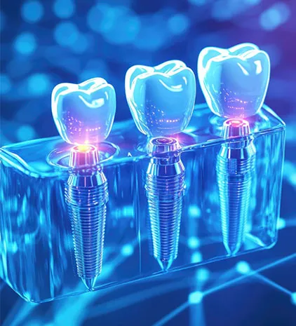 Oral surgery for dental implants in West Covina Smiles